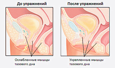 мышцы тазвого дна 2.jpg