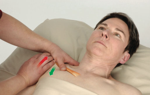 подключичная